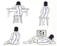 不良姿勢は腰痛の原因